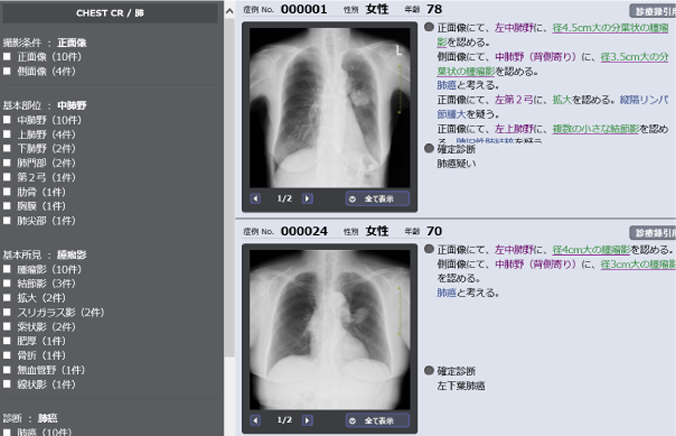 画像症例検索