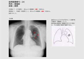 症例解説