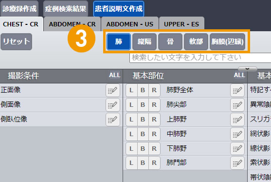 画像診断ナビゲーター Doc.navi 疾患説明