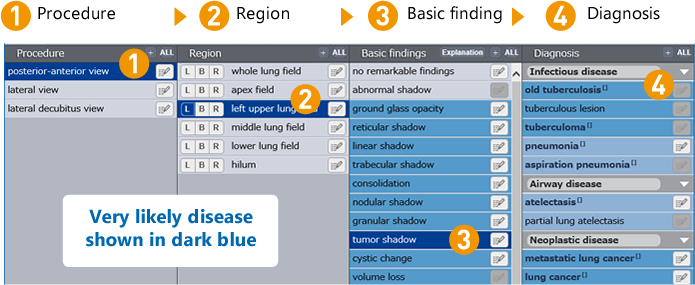 (1)Procedure > (2)Region > (3)Baseic finding > (4)Dianosis