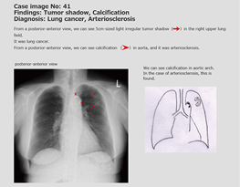 Case explanation