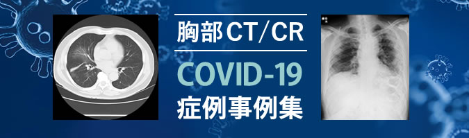 胸部CT/CR COVID-19 症例事例集