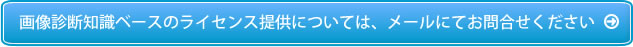 画像診断知識ベースのライセンス提供については、メールにてお問合せください