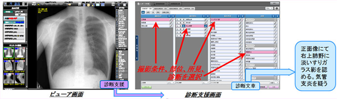 ビューア画面、診断支援画面