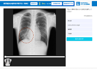 画像診断シミュレーター simu.Doc 胸部X線