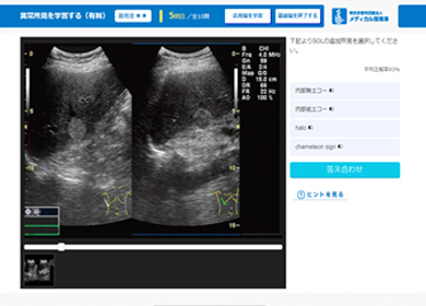 画像診断シミュレーター simu.Doc 腹部超音波